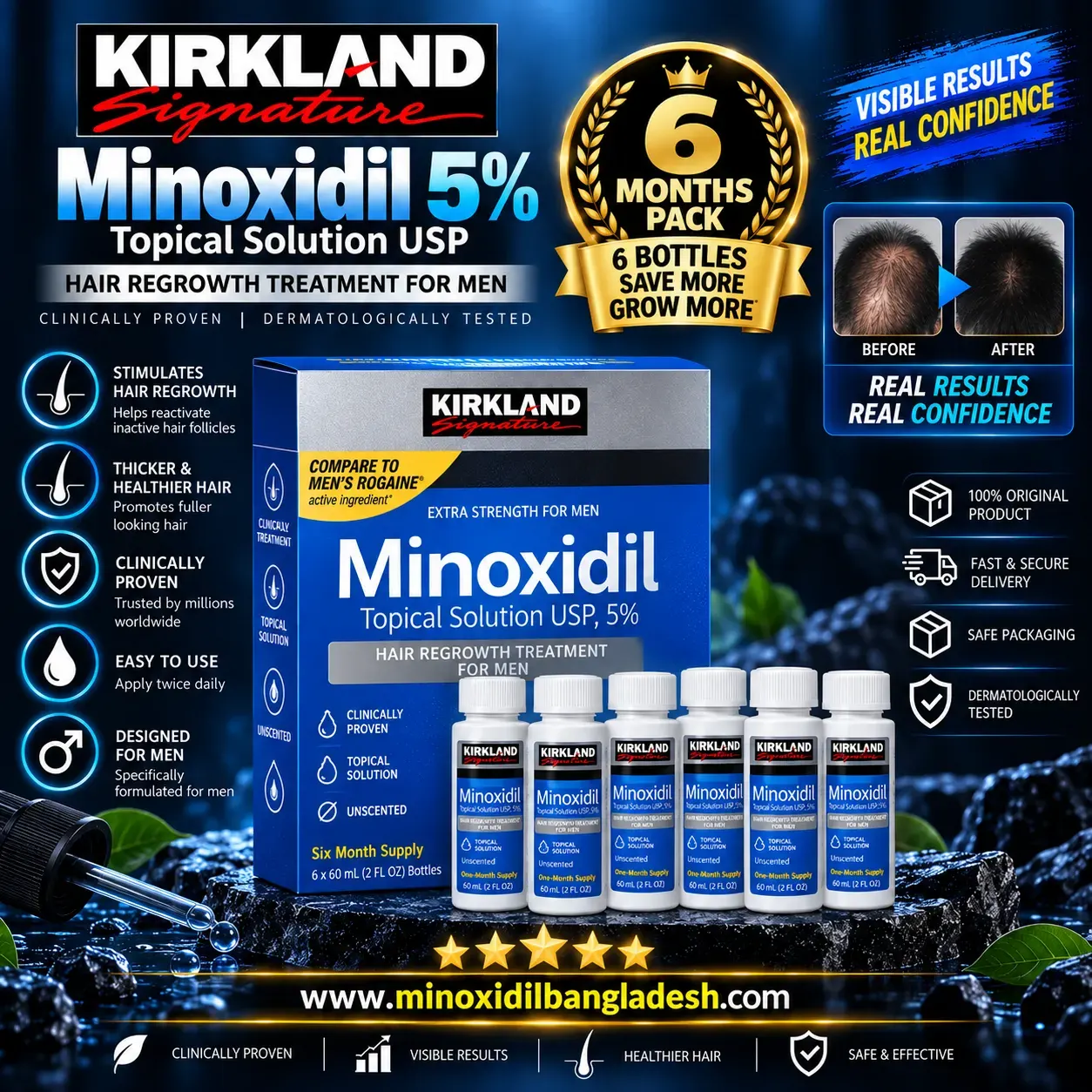 Kirkland Minoxidil Topical Solution 5% Beard & Hair Regrowth Treatment for Men 6 Months Supply 360ml