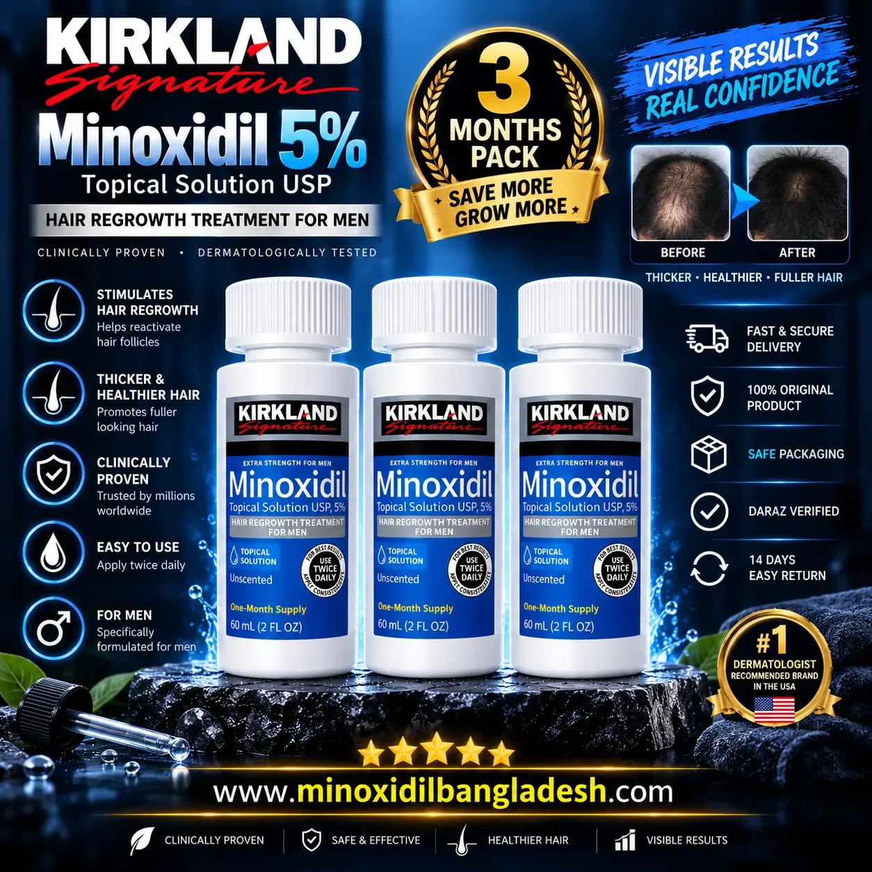 Kirkland Minoxidil Topical Solution 5% Beard & Hair Regrowth Treatment for Men 3 Months Supply 180ml