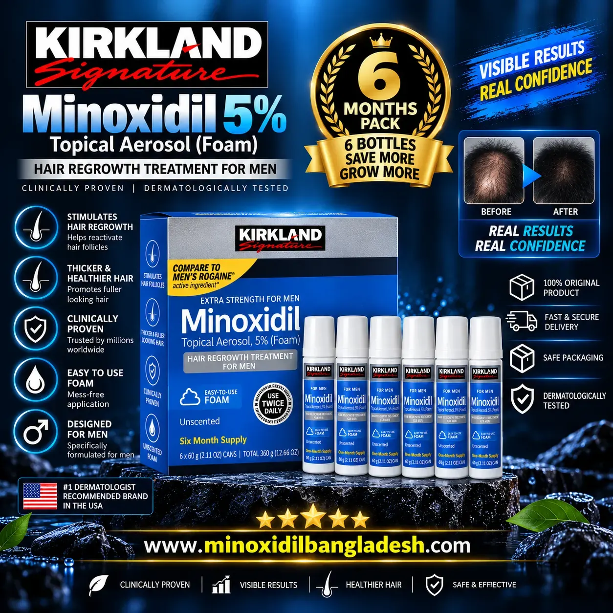 Kirkland Minoxidil Foam Mens hair and beard regrowth 5% 6 Month supply